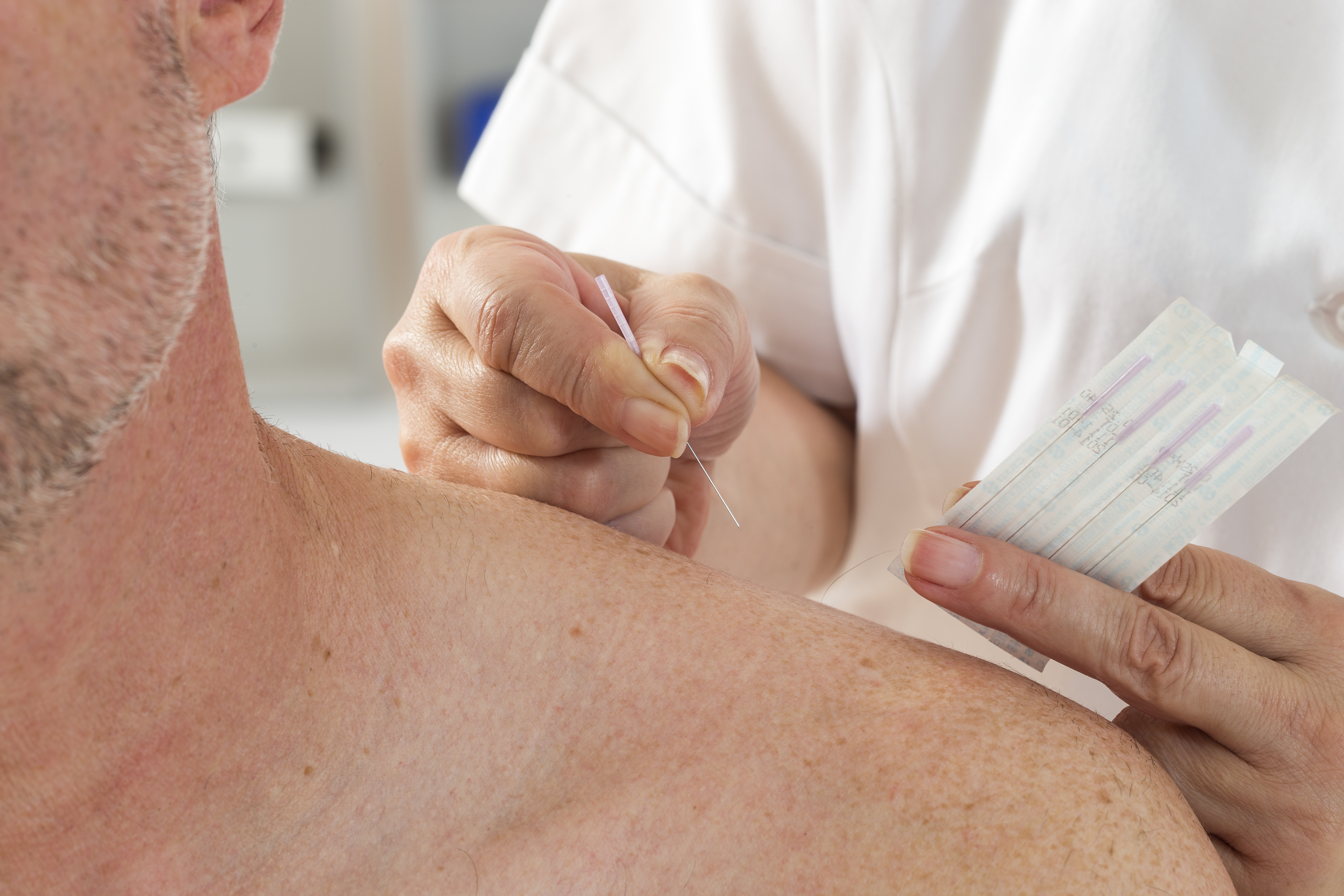 prescribing acupuncture for pain 3