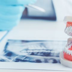 Being a Locum Dentist: What You Need To Know